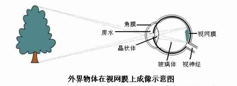 视网膜成像