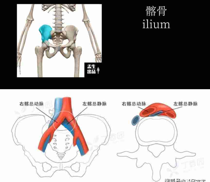 髂骨结构图